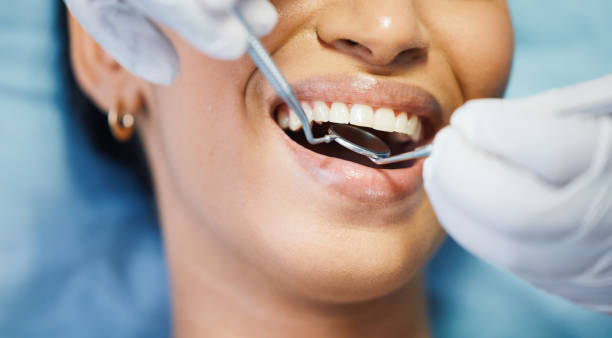 Best Emergency Wisdom Teeth Removal in Idalou, TX